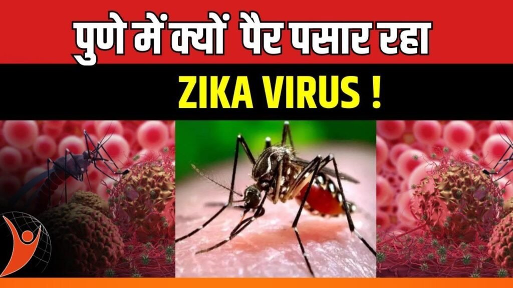 Zika Virus